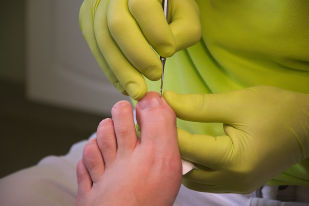 Podiatry feet