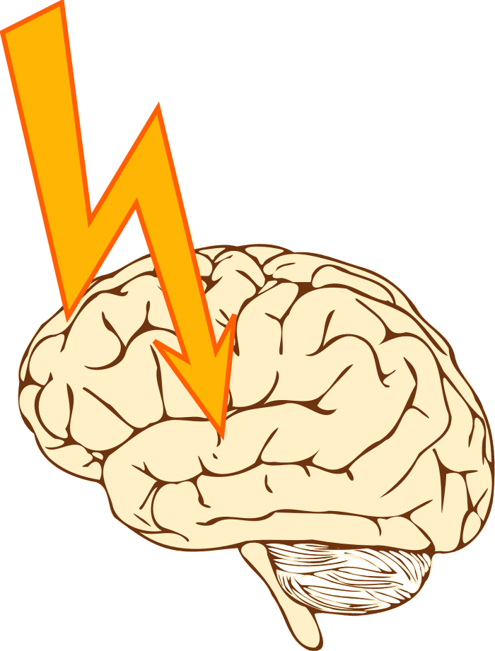 Epilepsy